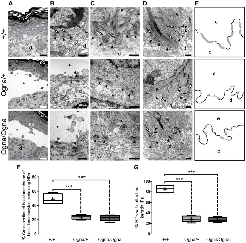 Histological and ultrastructural abnormalities of Ogna mouse skin.