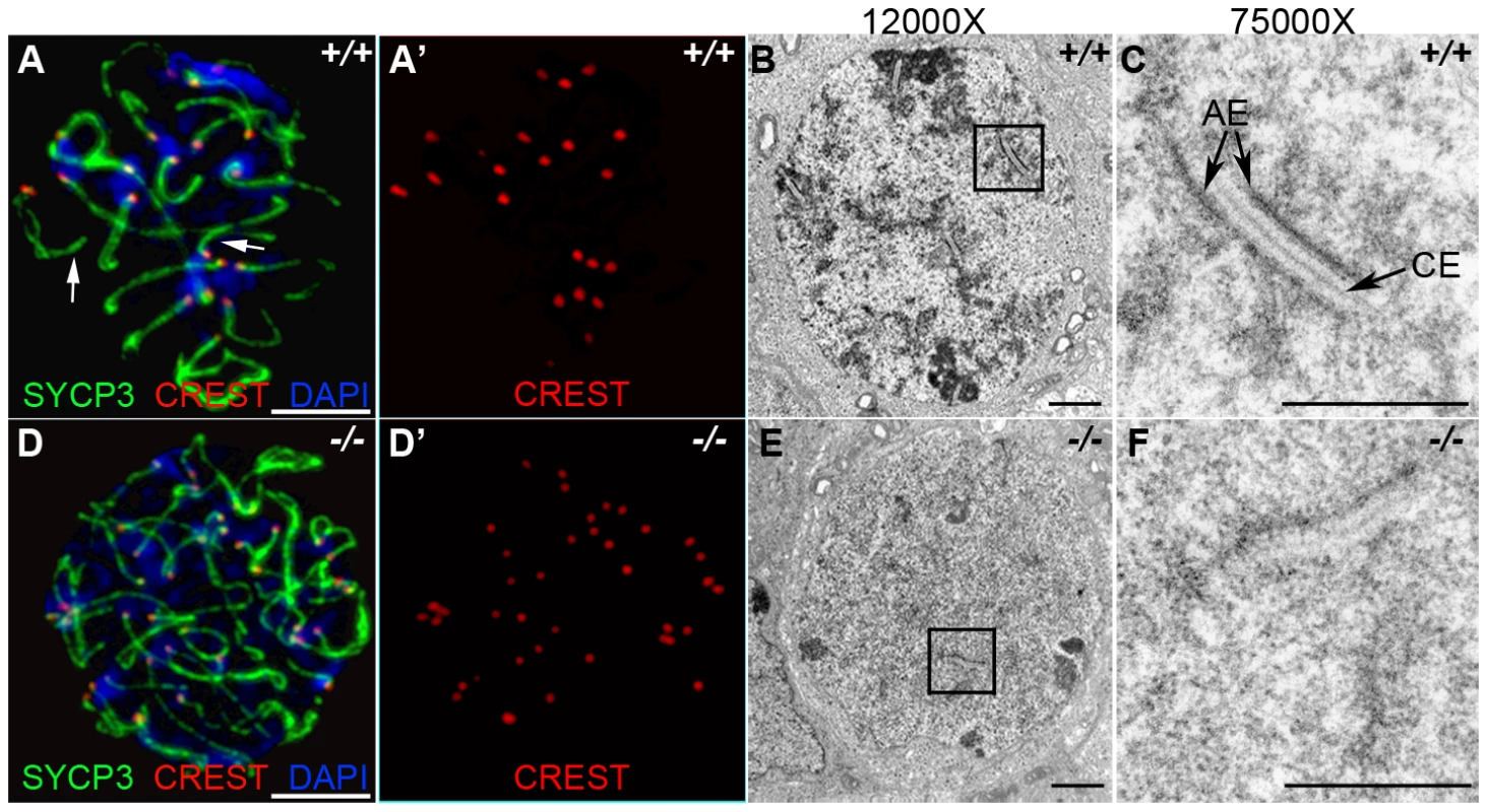 HORMAD1 is required for chromosome synapsis during male meiosis.