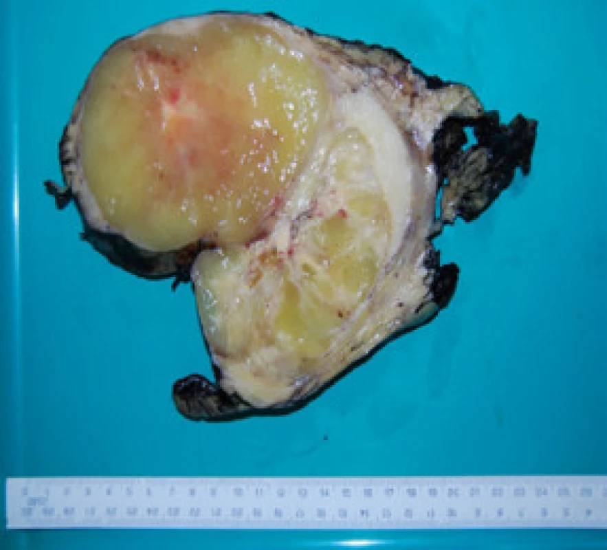 Řez tumorem
Fig. 3. Cross section of the tumor