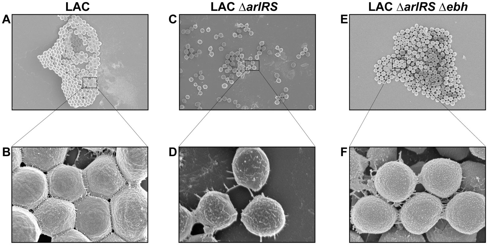 SEM of LAC-WT, LAC <i>ΔarlRS</i>, and LAC <i>ΔarlRS Δebh</i> clumps.