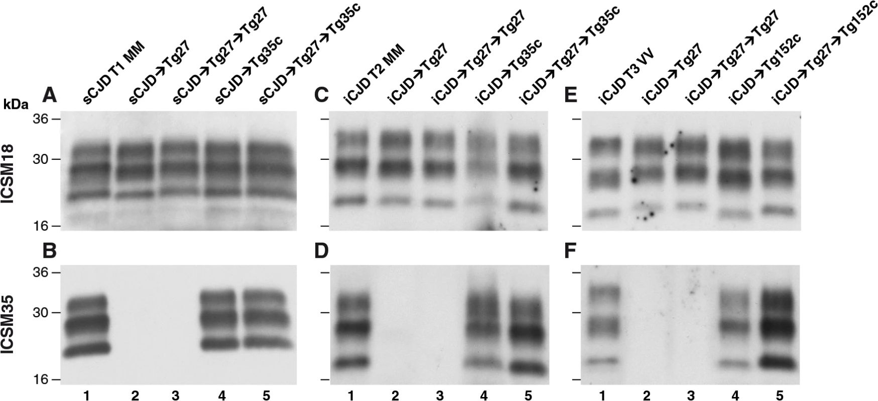 Immunoblot detection of PrP<sup>Sc</sup> in proteinase K-digested human and transgenic mouse brain homogenates using enhanced chemiluminescence.