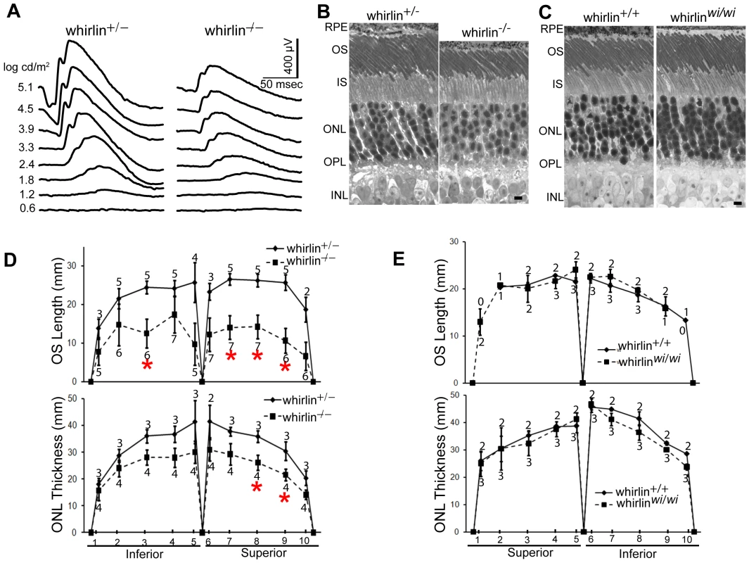 Retinal degeneration becomes apparent in whirlin knockout mice at 28–33 months of age.