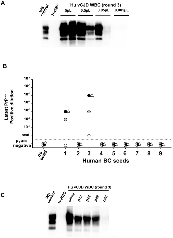 Analytical sensitivity of endogenous vCJD agent PMCA detection in the blood of affected patients.