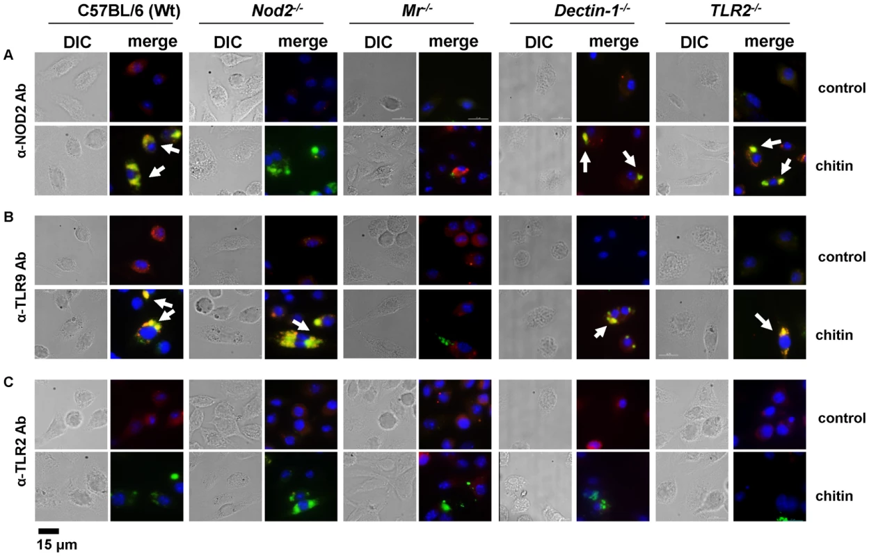Chitin co-localisation with NOD2 and TLR9 depends on MR.