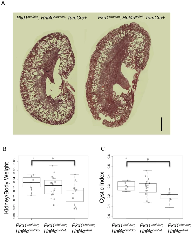 <i>Hnf4α</i> is a modifier of <i>Pkd1</i>-cystogenesis.