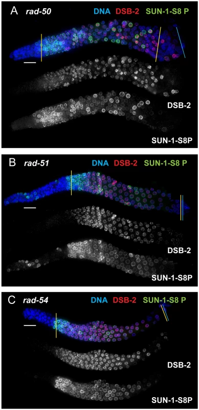 DSB-2 and SUN-1 S8P persist in mutants defective for DSB repair.