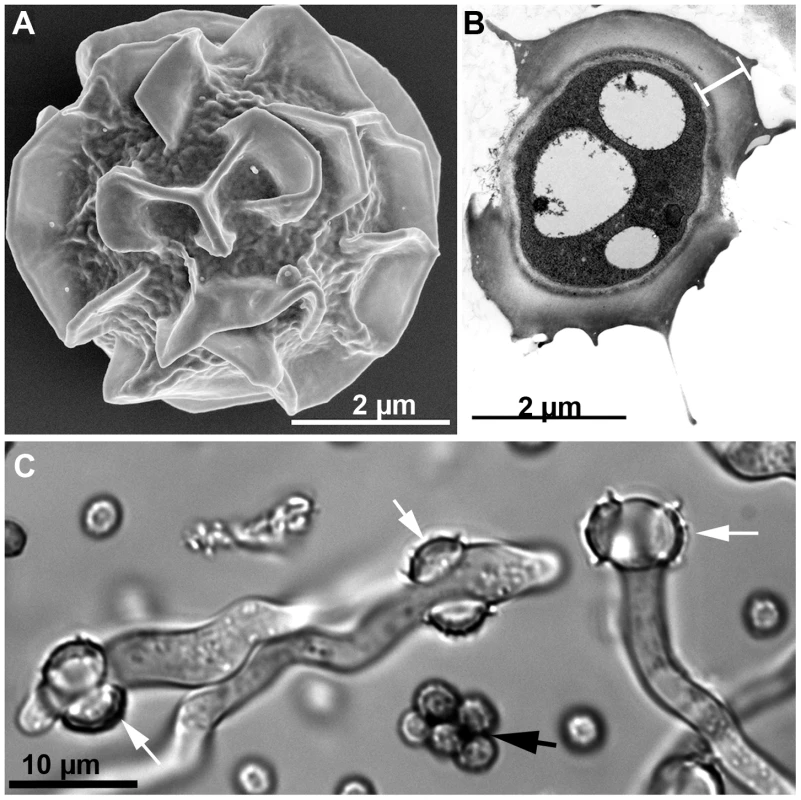 <i>Aspergillus fumigatus</i> ascospores.