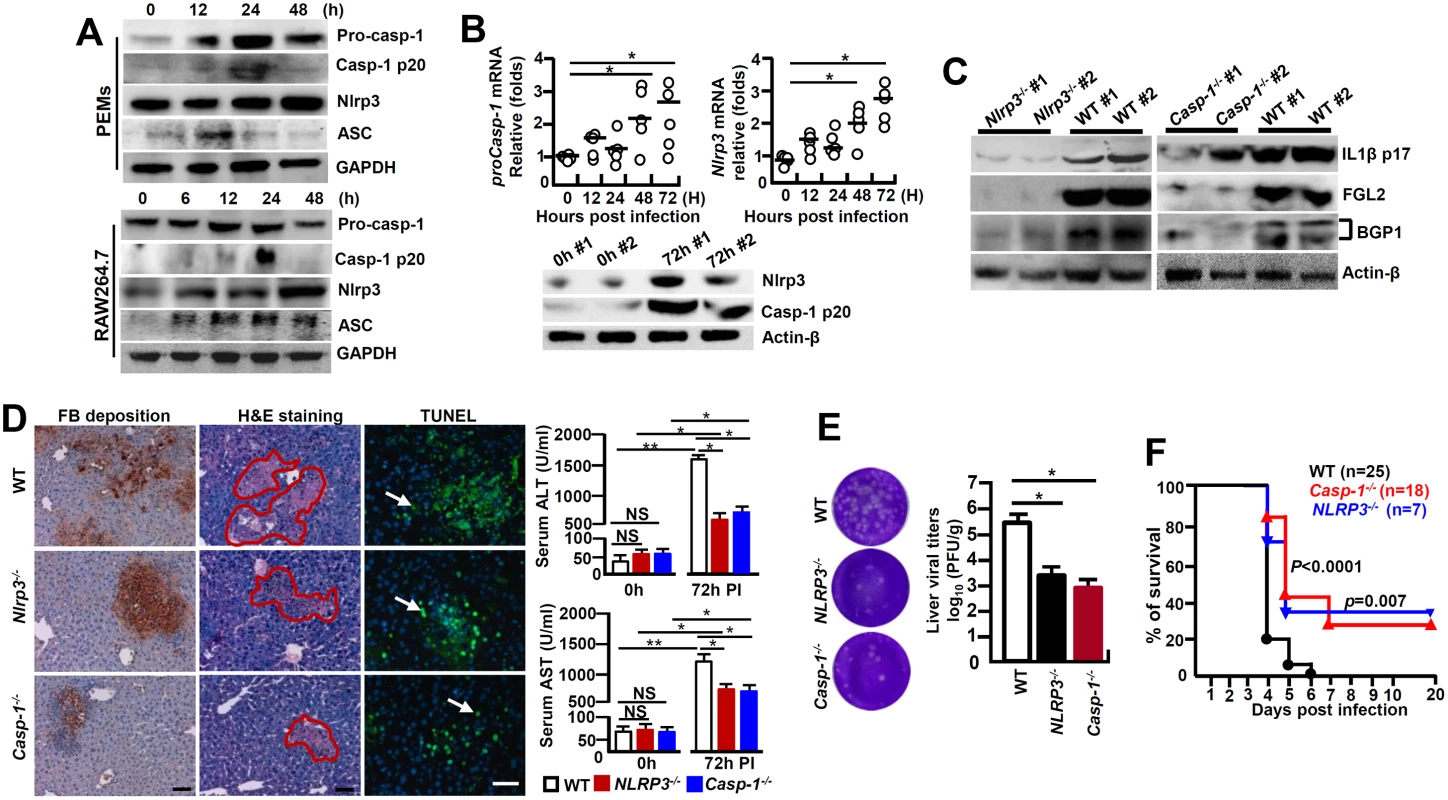 NLRP3 inflammasome involves in regulating the pathogenesis of MHV-3-mediated hepatitis.