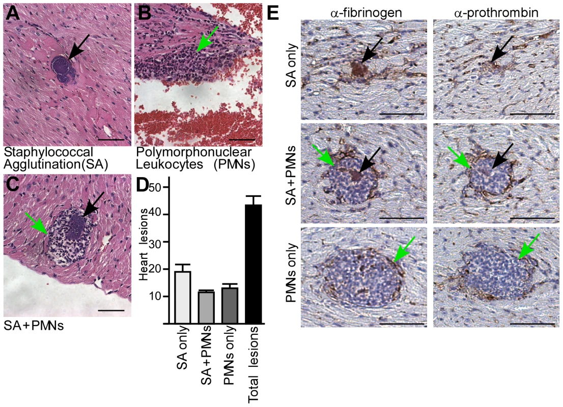 <i>Staphylococcus aureus</i> agglutination occurs during the pathogenesis of sepsis in mice.