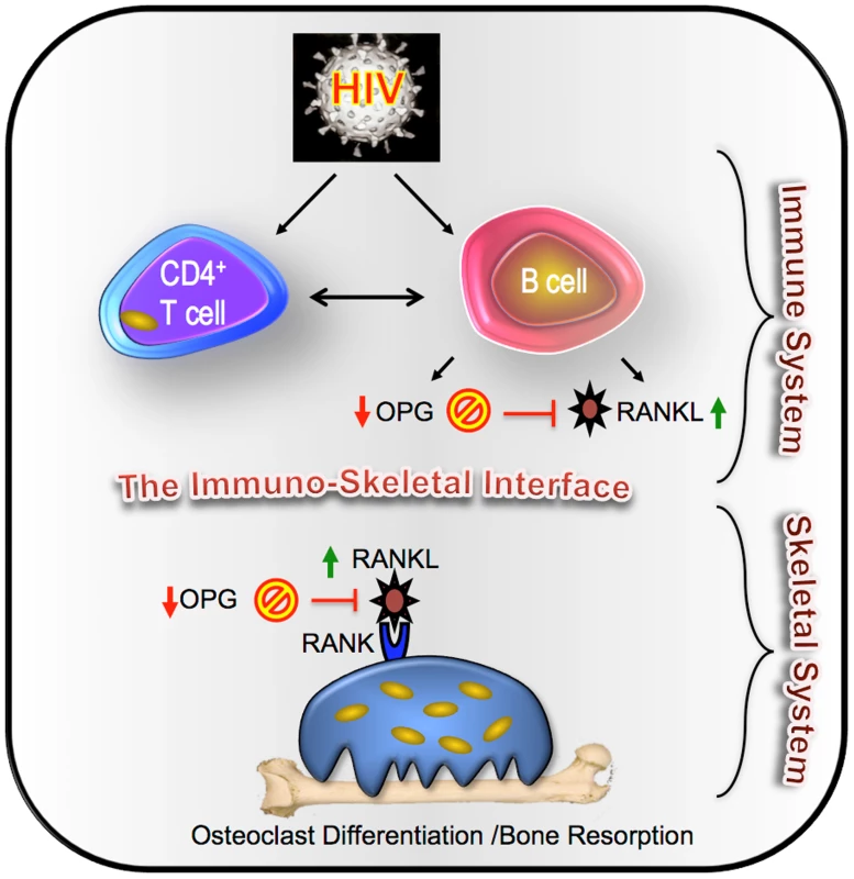 Immunocentric model of HIV induced bone loss.