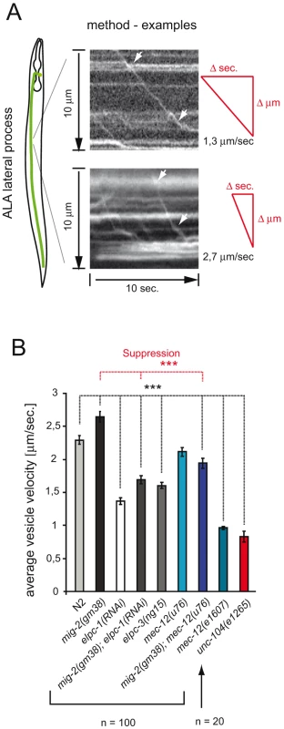 Velocity of Dense Core Vesicles is regulated by acetylation of α-tubulin.