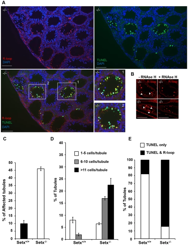 Accumulation of R-loops correlates with apoptosis.