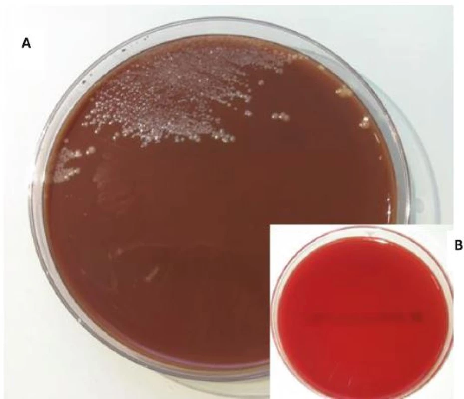 Culture of A. aphrophilus on chocolate agar (a) and blood agar (b) plates after 48 h under 5 % CO2