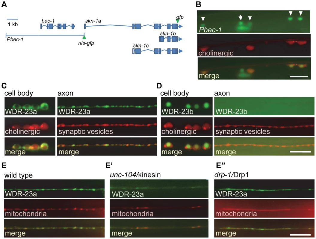 SKN-1 expression and WDR-23 sub-cellular localization in motor neurons.