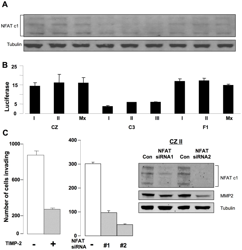 Activation of NFAT and secretion of MMP-2 are critical for invasion by metastatic bone tumor cells.