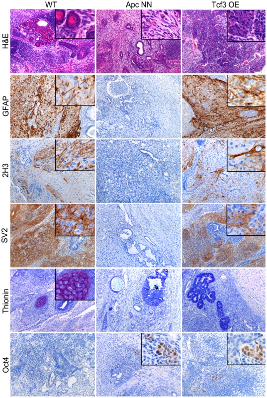 Rescue of <i>Tcf3</i> expression in <i>Apc</i>NN ESCs partially restores <i>in vivo</i> neural differentiation.