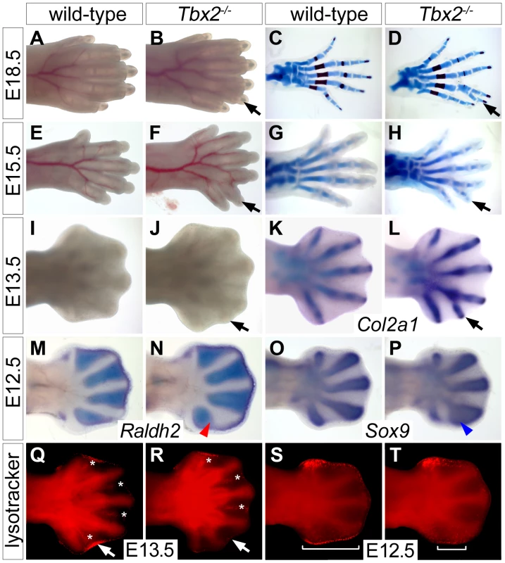 Duplication of digit 4 is preceded by reduced apoptosis and expanded chondrogenesis in the posterior limb mesenchyme.