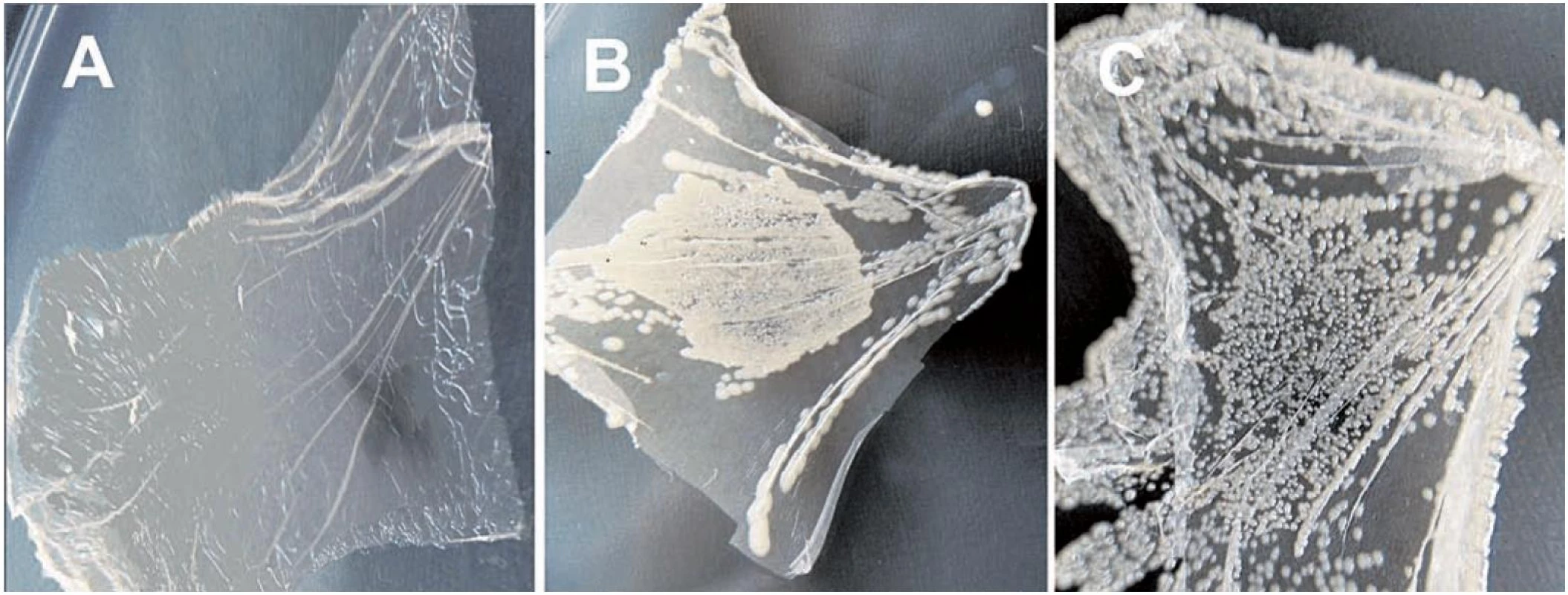 Antimikrobiální účinek nanotkanin při různých variantách experimentu
<i>Staphylococcus aureus</i> CCM 3953 byl inokulován na nanotkaninu (a) s fotosenzibilizátorem a osvětlováním, (B) osvětlovanou bez fotosenzibilizátoru a (C) s fotosenzibilizátorem ve tmě. osvětlované nanotkaniny byly exponovány světlu po dobu 30 min před dvanáctihodinovou inkubací při 37 °C na Muellerově-Hintonově agaru.