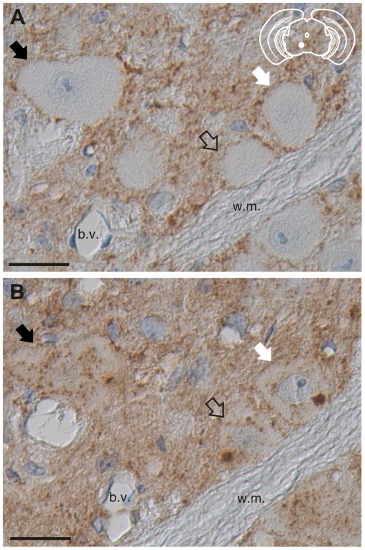 Truncation of the N-terminus of HY PrP<sup>Sc</sup> within neurons.