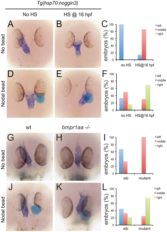 Rescue of Bmp-related cardiac laterality defects by Nodal beads.