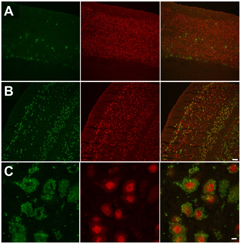 Numerous neurons in ventral cortex of double knockout, epileptic mouse store G<sub>M2</sub>.ganglioside.