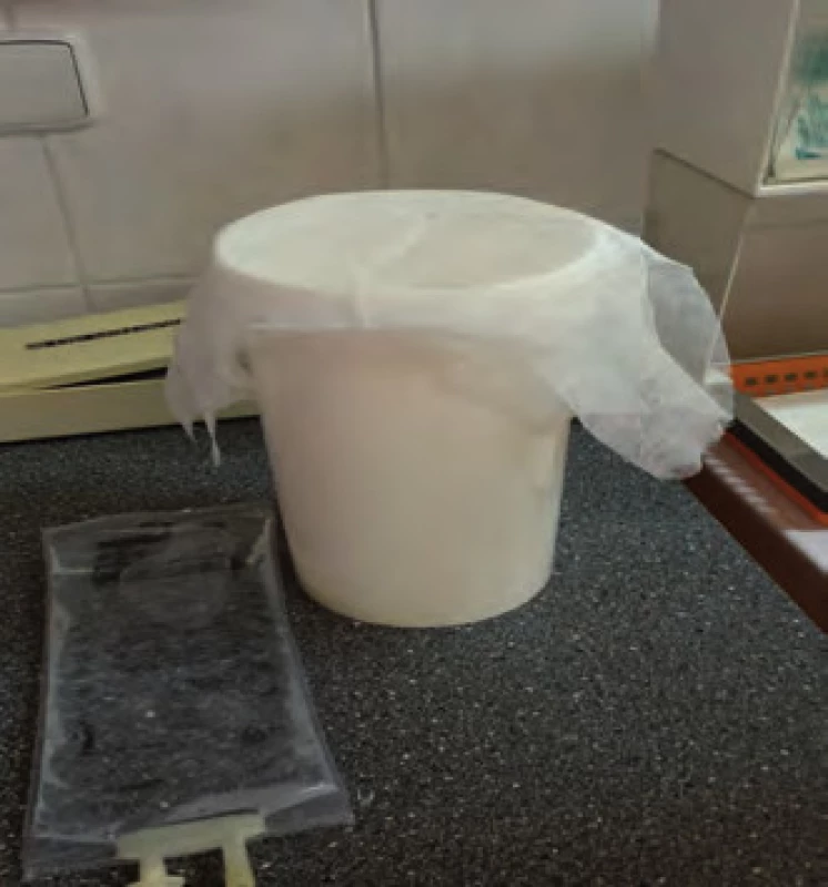 Filtrace přes sterilní gázu.
Fig. 1. Filtration through sterile gauze.