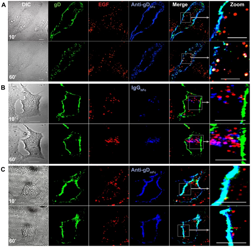 Lysosomal trafficking of HSV-1 gD and IgG under ABB-permissive and non-permissive conditions.