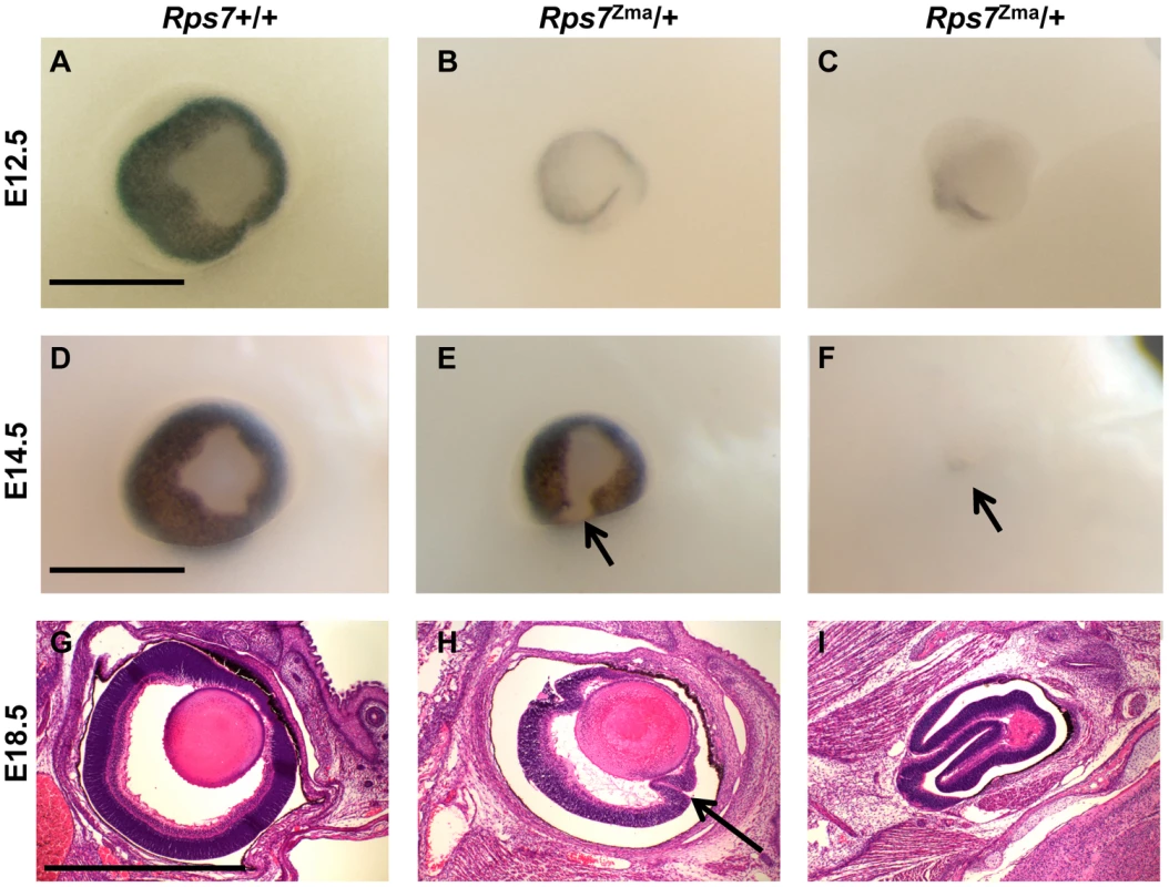 Eye dysmorphology in <i>Rps7</i> mutants.