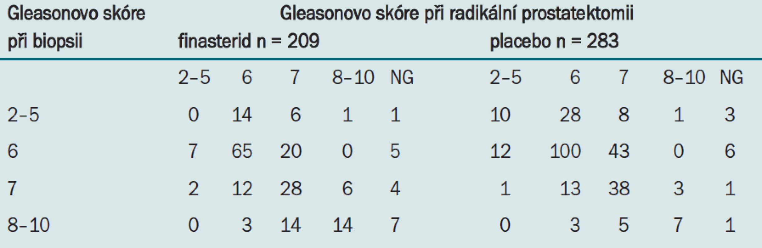 Souvislost mezi grade karcinomu při biopsii a při prostatektomii.