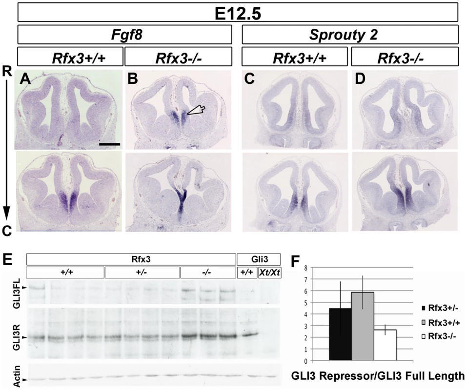 Disturbed expression of Fgf8 and of the ratio of GLI3 repressor/GLI3 activator forms in <i>Rfx3−/−</i> CSB.