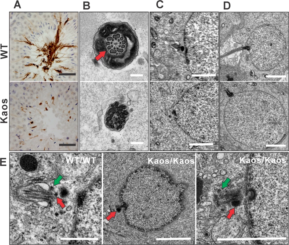 Axoneme defects in <i>Lrguk</i><sup><i>Kaos/Kaos</i></sup> mice.