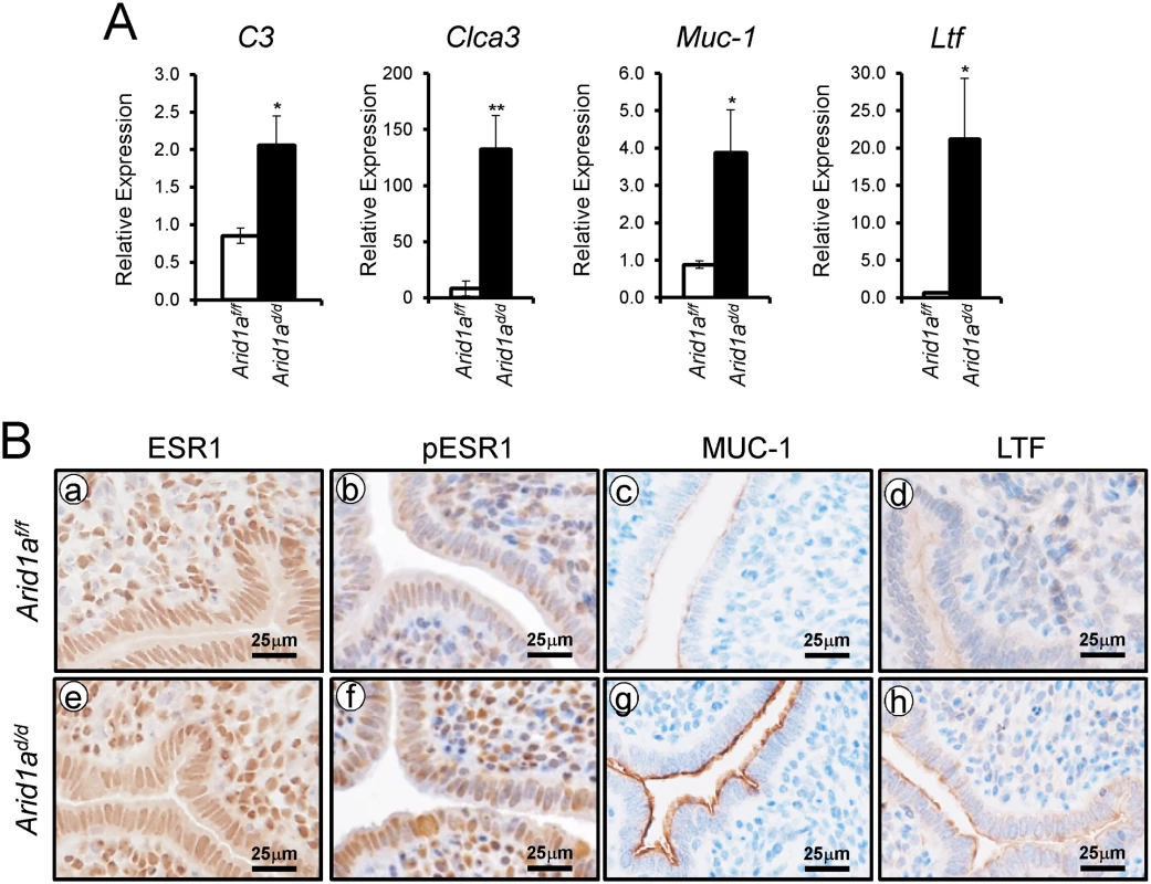 An increase of E2 signaling in <i>Arid1a</i><sup><i>d/d</i></sup> mice.