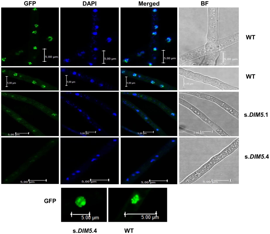 Location of LmHP1-GFP in nuclei of silenced-<i>LmDIM5</i> transformants and in the wild type isolate v23.1.3.