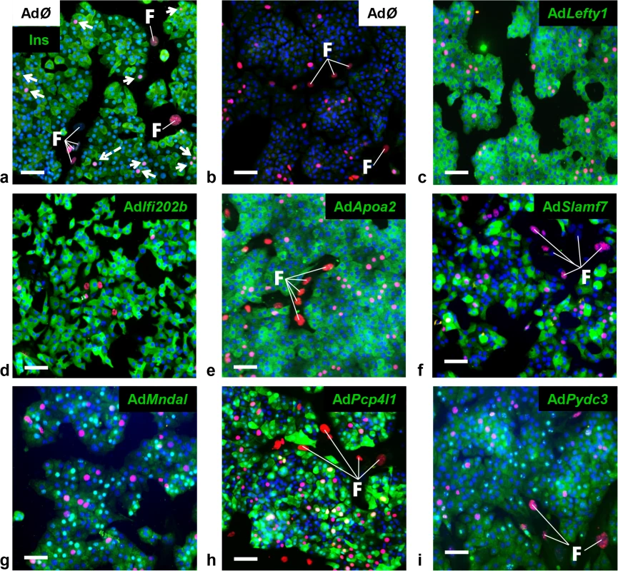 Detection of BrdU positive primary islet cells overexpressing candidate genes.