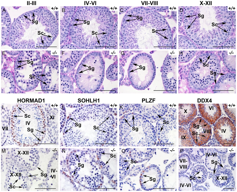 HORMAD1 is required for spermatogenesis.