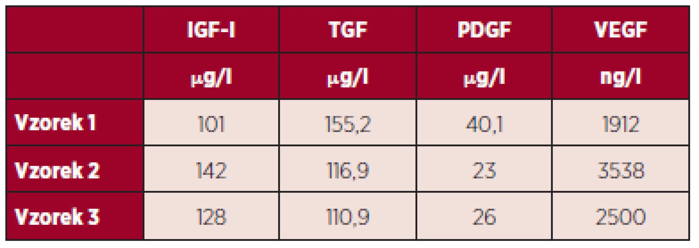 Výsledky měření hladiny vybraných destičkových faktorů v DL po smíchání, tepelné defibrinaci, inaktivaci komplementu a inaktivaci patogenů.