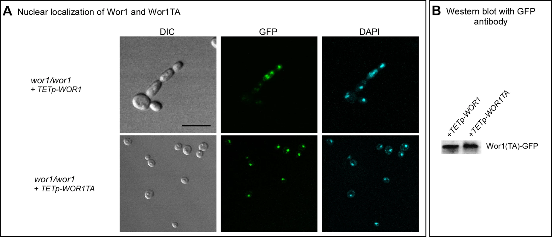 Wor1 localizes to the nucleus in the phosphorylated and unphosphorylated state.