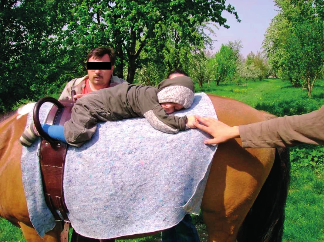 Dětská mozková obrna, kvadruparetická forma, suspektní poruchy kortikálních funkcí.