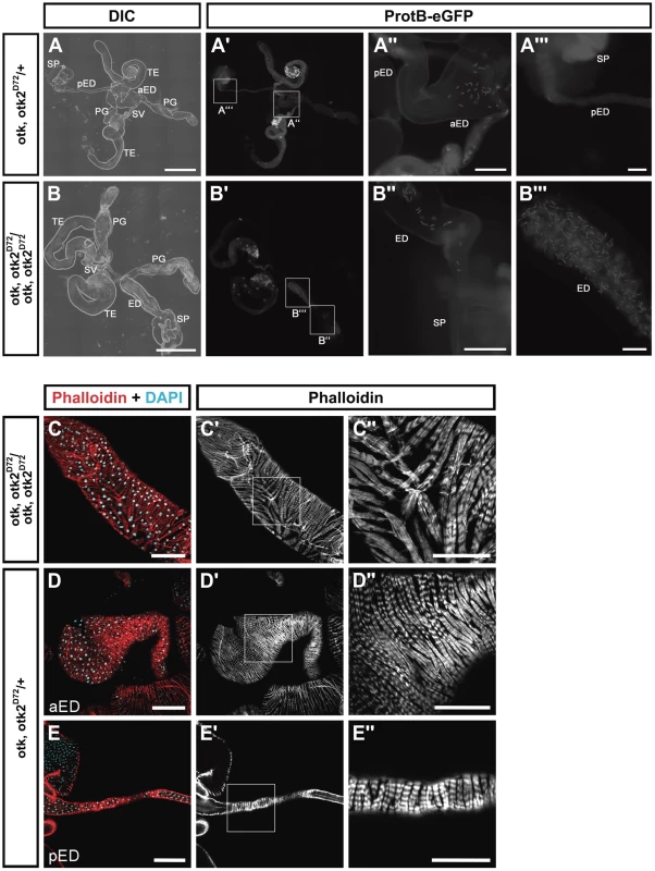 <i>otk, otk2</i> loss of function causes malformation and obstruction of the ejaculatory duct.