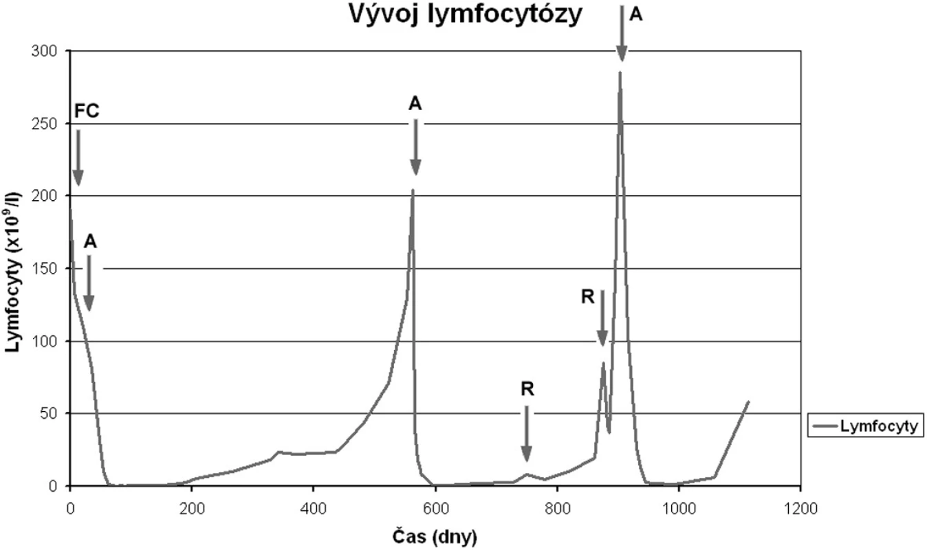 Kinetika absolutního počtu lymfocytů u pacienta 2. Šipky označují počátek jednotlivých terapií (A…alemtuzumab, R…rituximab). Po jednotlivých terapiích alemtuzumabem je velmi dobře patrné zkracování intervalů do progrese lymfocytózy.