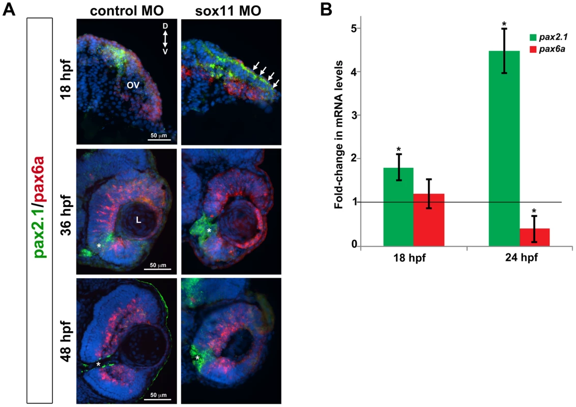 <i>Pax2.1</i> and <i>pax6a</i> expression is altered in <i>sox11</i> morphants.