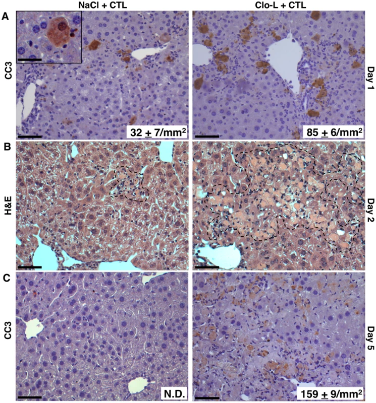Impaired removal of apoptotic hepatocytes and focal hepatocellular necrosis in Clo-L-treated mice.