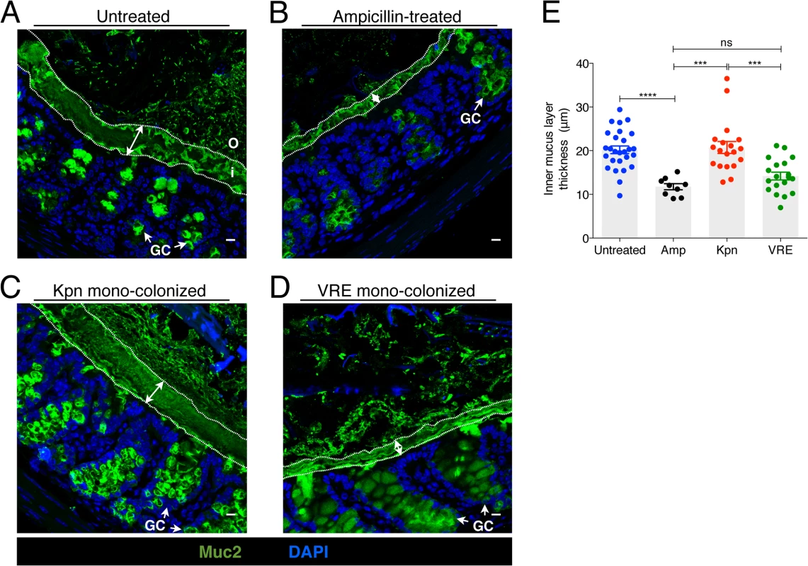 <i>K</i>. <i>pneumoniae</i> and VRE colonization influences the thickness of the inner mucus layer.