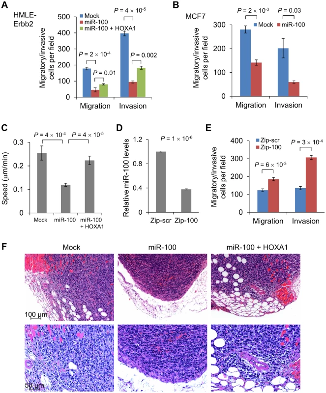 miR-100 inhibits migration and invasion by targeting <i>HOXA1</i>.