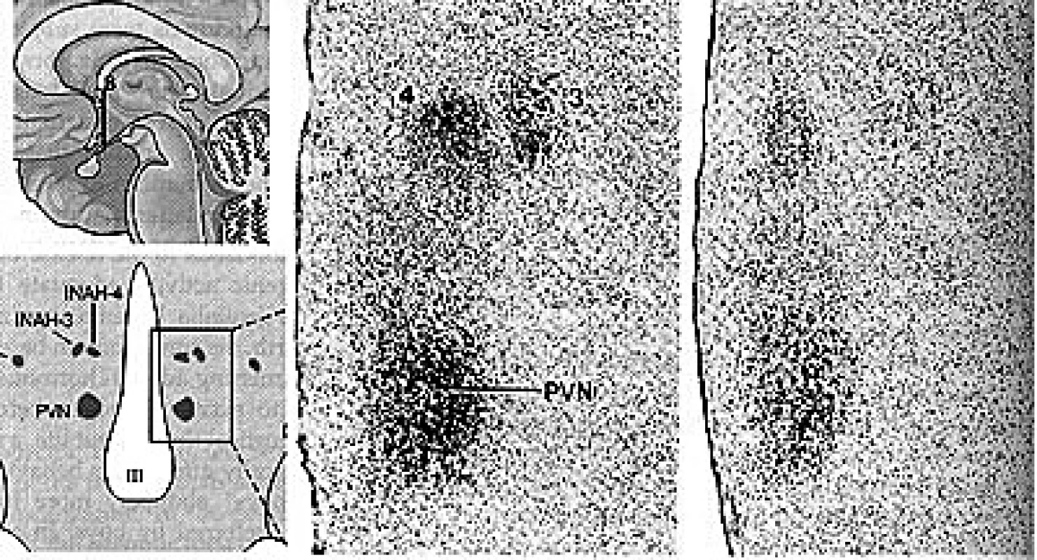 Hypotalamus v sagitální a čelní rovině, poloha intersticiálních jader 3, 4 PVN – paraventrikulární jádro, III – průřez třetí komorou