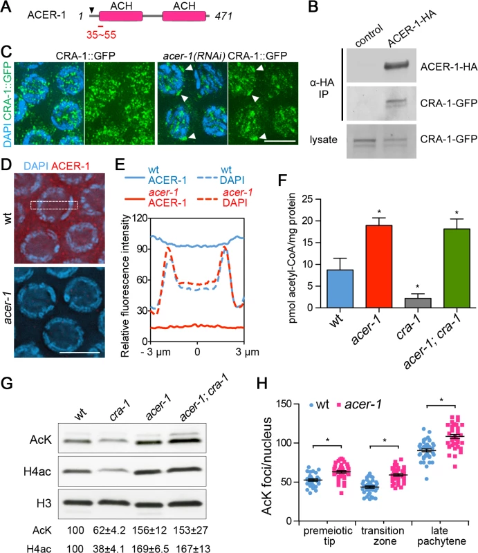 CRA-1 regulates histone acetylation by antagonizing ACER-1.