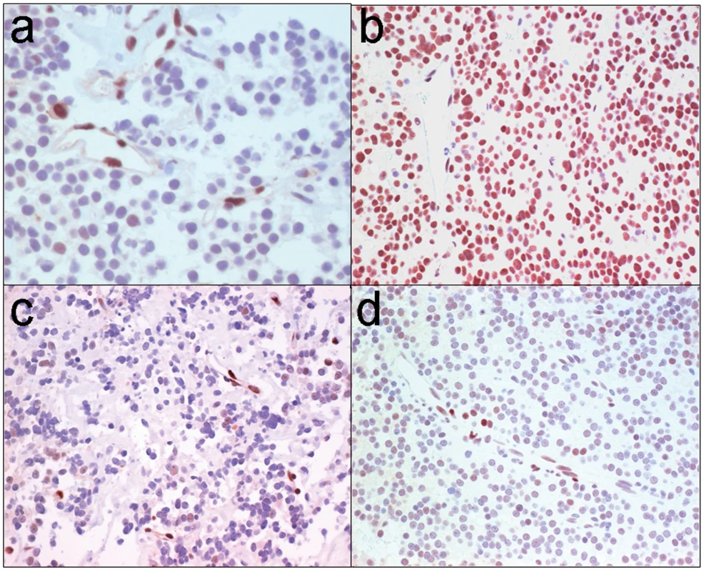 STAT3 serine phosphorylation in human GH pituitary tumors.