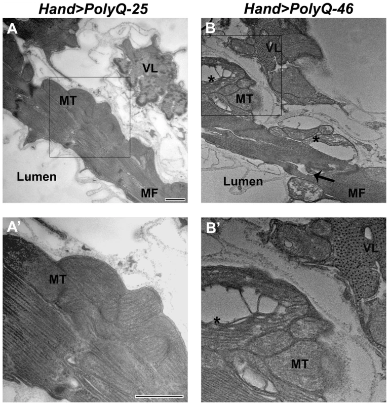 Mutant PolyQ causes myofibrillar and mitochondrial ultrastructural defects in the fly heart.