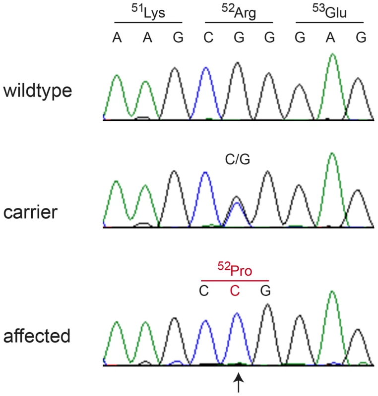 Electropherograms of the <i>FAM83G:c.155G>C</i> variant.