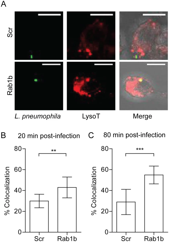 Knockdown of Rab1b increases <i>L</i>. <i>pneumophila</i> LCV acidification.